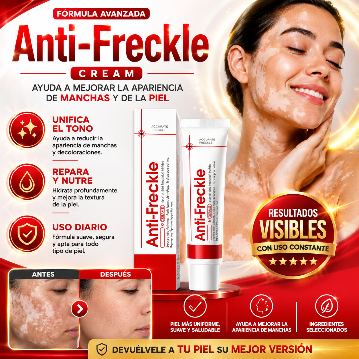 Anti-Freckle Cream | Luce una piel más suave y saludable